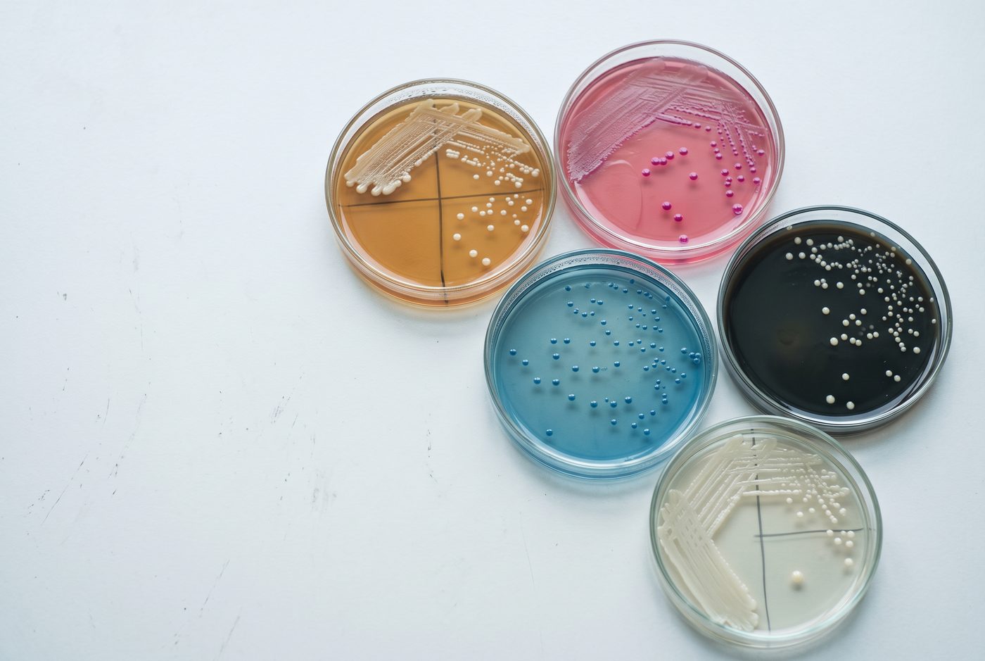 Five Petri dishes on a white bench, streaked with bacterial colonies on pink, blue, black, amber and clear agar.